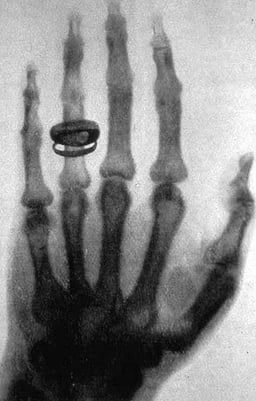 Is it possible to see X-rays with the naked eye?